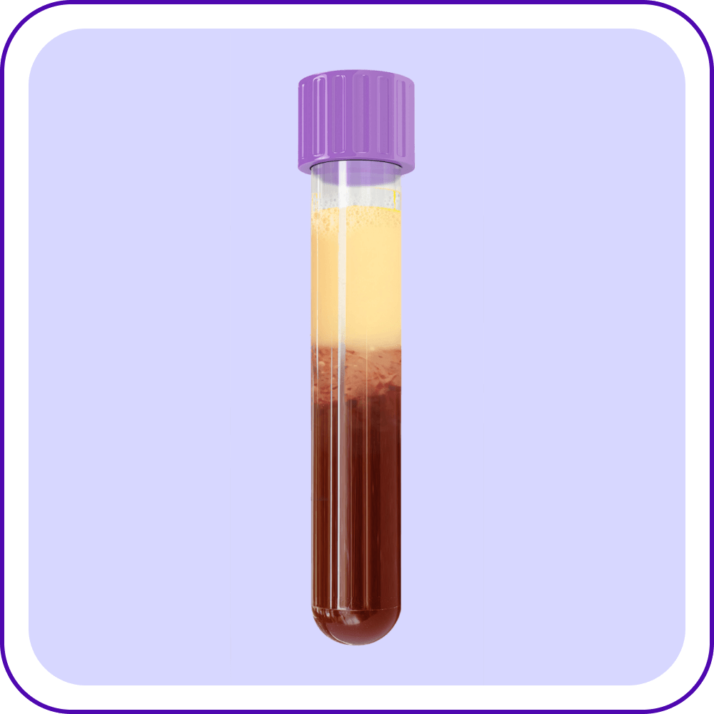 Blood Sample of a Patient with FCS