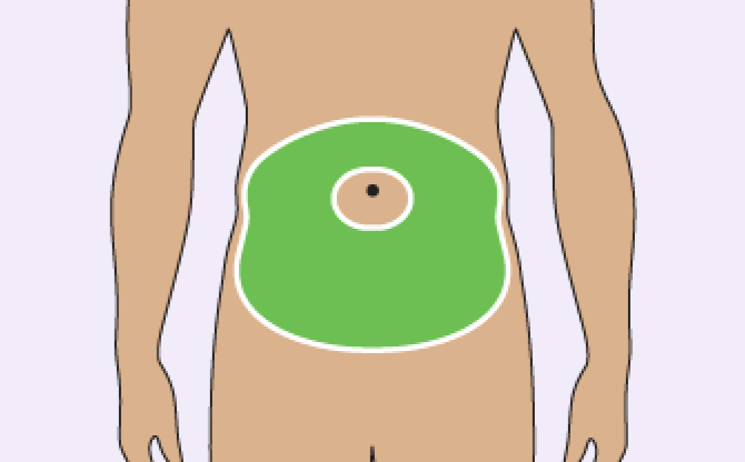 Diagram showing area for TRYNGOLZA injection: abdomen