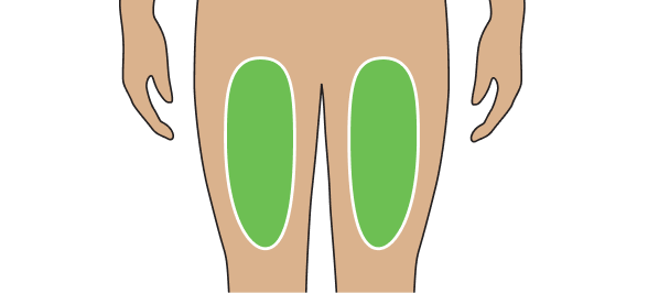 Diagram showing area for TRYNGOLZA injection: thigh.